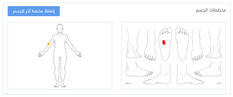 مخططات الجسم